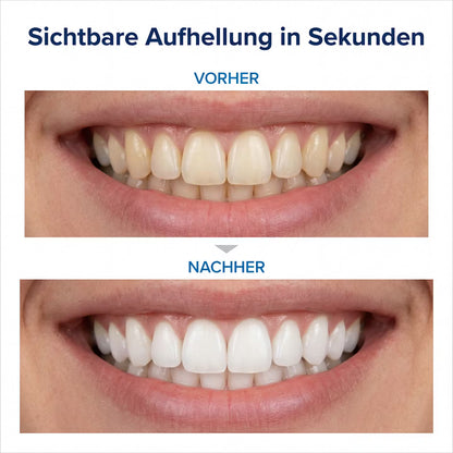 LUMIVIO™ Smile Pen V34